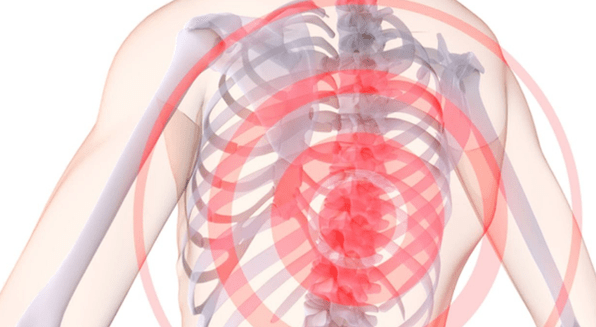 Dureri la nivelul coloanei vertebrale cu osteocondroză toracică