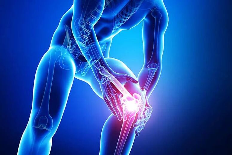 Simptomele osteoartritei